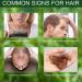 Rosemary Oil for Hair Growth 60ml | Nourishing Essential Oil for Scalp Massage | Bio Rosemary Oil for Men and Women - Buy Online on GoSupps.com
