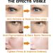 Hydrating Serum - Vitamin C Serum for Face - Hyaluronic Acid Serum for Face - Skin Care Face Serum - Dark Spot Correcting Glow Serum - Anti Aging & Wrinkle Vitamin C Serum - Face Serum for Women - Buy Online on GoSupps.com