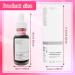 ARONRAVE AHA 30% + BHA 2% Peeling Solution Fruit Acid Exfoliating Face Scrub Liquid Exfoliating Face Scrub Salicylic Acid Liquid for Even Smooth Skin - Buy Online on GoSupps.com