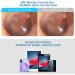 Vitcoco WiFi Ear Cleaner Camera | 5MP HD Otoscope | IP67 Waterproof Ear Endoscope for iPhone iPad & Android - Ear Axle Removal Tool - Buy Online on GoSupps.com