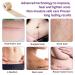 Silicone Scar Sheets Roll 1.6 x 60 - Waterproof Reusable Silicone Strips for C-Section Surgery, Burns, Injuries, Acne, Stretch Marks - Breathable Scar Tape for Skin Patch Away - Buy Online on GoSupps.com
