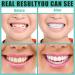 6 Set Fake Teeth Veneers with Mini Tweezers - Temporary Denture for Men and Women - Confidence Smile Solution - Bad Teeth Whitening Alternative - Buy Online on GoSupps.com