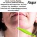 Sharp Pointed Tweezers Precision Fine Point Tip Ingrown Hair Tweezers Kit Best Pointed Tweezers for Women Chin Hair Removal - Extra Thin Tweezers Precision Stainless Facial Hair Remover for Face Green Color - Buy Online on GoSupps.com