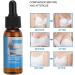 Essential Oil for Breast Enlargement - Strong Absorption Promotes Fat Accumulation for Women | International Shipping Available - Buy Online on GoSupps.com