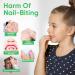 Stop Nail Biting & Thumb Sucking Treatment for Kids - Bitter Taste, All Natural Formula - 0.35 Fl Oz (Pack of 1) - Buy Online on GoSupps.com