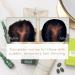 Rene Furterer Reactional Thinning Hair Ritual - Drug-Free Solution for Sudden Thinning Hair | International Shipping - Buy Online on GoSupps.com