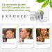 Exposed Skin Care Acne Treatment Kit - Complete Natural Solution for All Ages and Skin Types - Buy Online on GoSupps.com
