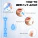 Sterile Pimple Needles & Acne Stickers Set - 122 Pcs for Effective Blemish & Blackhead Removal | Disposable Tools for Clear Skin - Buy Online on GoSupps.com