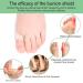 Dykook Ballen Toe Corrector 8 Pieces Gel Protection for Hallux Valgus Big Toe Pain Relief & Bunion Prevention - Buy Online on GoSupps.com