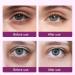 Under Eye Firming Oil - 10ml Roll On Smoothing Tightener for Delicate Skin | Nourishing Eye Care with Gentle Hydration & Anti-Fatigue Support for Weekend Regimen Evening Repair Holiday Travel - Buy Online on GoSupps.com