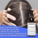 Prevents hair loss rub hair lotion with biotin 30 ml BINGOSPA - Buy Online on GoSupps.com