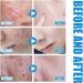 Face Serum Hyaluronic Acid Serum Collagen Boosting Serum Reduce Hyperpigmentation And Anti Aging Serum For Face Skin Repair Acne Dark Spot Remover Fine Line And Wrinkles Face Serums Skincare - Buy Online on GoSupps.com