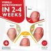Natural Ingrown Toenail Treatment & Pain Relief Drops - 30ml (1 bottle) - Buy Online on GoSupps.com