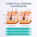 Dinocook Razor Bumps Treatment for Women and Men Ingrown Hair Treatment After Shave Repair for Bikini Area Face Neck Legs and Underarm Area After Shave for Women and Men Ingrown Hair Serum green - Buy Online on GoSupps.com