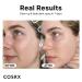 COSRX Pure Vitamin C 23% Serum | Brightening & Hydrating Facial Serum | Dark Spots, Fine Lines, Uneven Skin Tone | 0.7fl.oz/20ml - Buy Online on GoSupps.com
