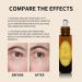 Huile de R sine d'encens Biologique et Huile de ricin - S rum Anti- ge Sous les Yeux avec huile essentielle d'encens pour le Visage les Poches sous les Yeux les Cernes les Rides (10ml 1pc) 1pc 10 ml (Lot de 1) - Buy Online on GoSupps.com