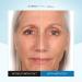 Serious Skincare Insta-TOX Instant Wrinkle Smoothing Serum - 0.75 oz - Skin Tightening Facial Serum - Buy Online on GoSupps.com