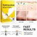 12PCS Hydrocolloid Nose Patch for Pore Cleansing and Blackhead Removal | Pimple Zit Oil Control Strips - Buy Online on GoSupps.com