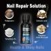 Effective Toenail Fungus Treatment - Repair & Renew Damaged Nails | 30ML Nail Fungus Solution - Buy Online on GoSupps.com