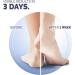 Scholl Cracked Heel Repair Cream 60ml - Effective Treatment for Dry and Cracked Heels - Buy Online on GoSupps.com