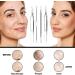 Dermated 16 PCS Blackhead Remover Pimple Popper Tool Kit | Stainless Acne Extraction Set for Face & Nose | Blemish & Whitehead Remover Tools in Metal Case - Buy Online on GoSupps.com