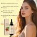 Battana Hair Care 100ml. Natural Battana promotes hair growth improves dryness and roughness and moisturizes the scalp and hair. Suitable for all hair types. - Buy Online on GoSupps.com