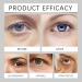QPJUVC Retinol Eye Balm Stick removes eye bags and puffiness in minutes antiaging eye cream for dark circles and fine lines with hyaluronic acid and turmeric 1 - Buy Online on GoSupps.com