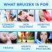 Bruizex Ultra Bromelain & Quercetin Supplement - 120 Capsules | Skin Trauma Recovery | Anti-Bruising & Swelling Support with Turmeric & Boswellia - Buy Online on GoSupps.com