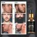 Thesosy Beard Growth Essential Oil | 7-Day Beard Growth Essence for Stylish Beard Care - International Shipping Available - Buy Online on GoSupps.com