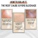 Lactobionic Acid Pore Refining Serum Reduce Fine Lines Facial Liquid Lactobionic Acid Pore Shrink Face Serum Lactobionic Acid Shrink Pore and Reduce Fine Lines - Buy Online on GoSupps.com