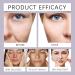Lifting Cream Face Anti Aging Face Cream Face Moisturizer Anti Wrinkle Face Cream Moisturizing Collagen Cream Night Cream For Women Anti Aging Tightening Lifting Sagging Skin Smooth Fine Lines - Buy Online on GoSupps.com