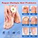 Buy Extra Strength Toenail Fungus Treatment - Fast Acting Nail Fungus Remover for Men & Women - 30mL Liquid Solution - Buy Online on GoSupps.com
