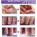 Nail Fungal Treatment Spray - Advanced Toenail & Nail Strengthener Repair - 10ml - Buy Online on GoSupps.com