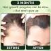 Organic Rosemary Oil for Hair Growth | 100% Pure & Natural | Cold Pressed | Hexane Free | Hair Strengthening Treatment with Jojoba & Castor Oil (8 Fl Oz - Buy Online on GoSupps.com