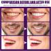 Concentrated Mouthwash for Fresh Breath & Whiter Teeth | Clean Stains & Remove Yellowing - International Shipping Available - Buy Online on GoSupps.com