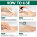 Advanced Silicone Scar Gel Treatment for Surgical, Acne, Stretch Marks & More - 1.7oz (50ml) - Buy Online on GoSupps.com