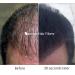 Buy BLACK Original Samson Hair Loss Building Fibers - 50g | Effective Solution for Thinning Hair - Buy Online on GoSupps.com