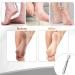 Stainless Steel Hornhaut Hobel Foot Scraper Set - Corn al Remover & Pedicure Tools with 10 Replacement Blades for Effective Hard Skin & Heel Care - Buy Online on GoSupps.com