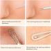 Powmok Blackhead Remover Tools Pen Stainless Steel Green Facial-blemish-and-blackhead-remover with Camera WIFI Connect 30x Magnification 20MP 180-days Warranty - Buy Online on GoSupps.com