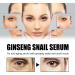 Repair Serum: Ginseng + Snail Mucin -Dark Spot Remover for Face - Niacinamide Serum for Improve the Water-oil Balance - Repair Damaged Skin for All Skin Types - Skin Care 30ml - Buy Online on GoSupps.com