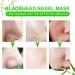 80 Pcs Blackhead Remover Strips for Nose Bamboo Charcoal Deep Cleansing Pore Strips for Blackheads Nose Blackhead Remover Strips for Women Men (Black) - Buy Online on GoSupps.com