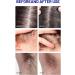 Head Lice Shampoo Lice Remover Shampoo Bar with Peppermint Oil Oil Control and Lice Prevention all in 1 shampoo Organic lice shampoo bar Lice prevention shampoo Suitable for Women and Men - Buy Online on GoSupps.com