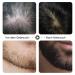 Dr.Roller Beard Serum - Stimulate Beard Growth | 30ml Men's Beard Oil for Thicker Hair - Buy Online on GoSupps.com