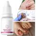  G n rique Nail Hardener Nails Nutrient Oil 10ml Natural Cuticle Oils Repair Softener Optimal Nail Revitalization for Foot Care Fingernails Yellow Toenail Ingrown Women and Men - Buy Online on GoSupps.com