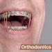 Buy 300 Medium Orthodontic Rubber Bands - Dental Elastics for Braces & Invisalign | Perfect for Orthodontist & Personal Use - Buy Online on GoSupps.com