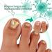 Nail Repair Essence for Fingernail & Toenail Fungus - Repairs, Protects, and Strengthens Nails (3 Pcs) - Buy Online on GoSupps.com