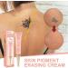 Mandurs 7 Days Tattoo Removal Cream - Fast & Painless Gel for Colored & Black Ink - 2PCS - Buy Online on GoSupps.com