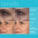 MD Complete Eye Wrinkle Duo - Wrinkle & Radiance Remedy + Total Eye Treatment | Dermatologist Approved Skincare | Retinol 1.0 fl oz + Hyaluronic Acid 0.5 fl oz - Buy Online on GoSupps.com