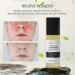 Azelaic Acid 10% Serum - Reduces Facial Redness | 3.4 fl. oz. (100ml) - Best Azelaic Acid Serum for Face | International Shipping Available - Buy Online on GoSupps.com