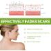 Goopgen Advanced Scar Repair Serum - Medical Grade Treatment for All Types of Scars - 1pc - Buy Online on GoSupps.com